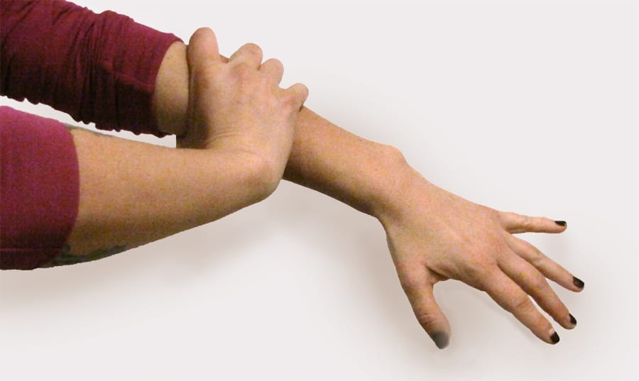 Myofascial stretch for hand stiffness - 1